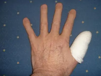 LeftThumb.webp
