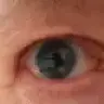 eyeball652009